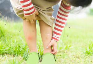 На какво се дължат сърбежите и защо почесването е толкова приятно
