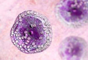 Ето как да намерим потенциално най-доброто лечение за лимфома