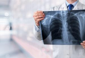 Пушите? Ето кои храни помагат за възстановяване на белите дробове