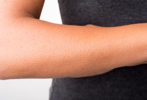 Мозъкът на хората, чиято кожа настръхва, докато слушат музика, е устроен различно