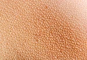  Науката обяснява: Защо настръхваме