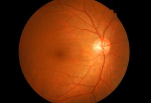 Създават човешка ретина буквално от нулата