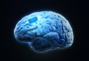 Усилиха човешката памет с мозъчен имплант
