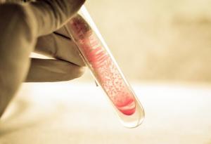 4 неща, които трябва да знаете за антибиотичната резистентност