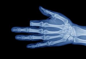 След ухапване от змия мъж отрязва пръста си, за да „спаси живота си“. Оказва се, че не е било нужно