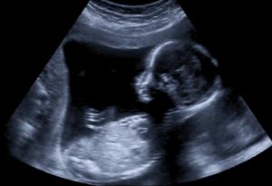 В рамките на месец жена роди 2 пъти