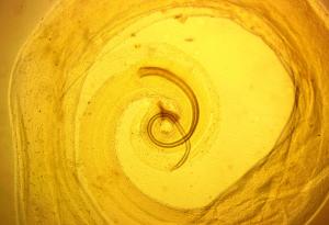 Най-ужасните паразити на света - пренебрегваните тропически болести