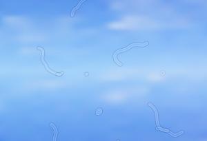 Чували ли сте за „мушици” в очите?