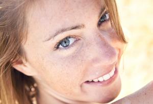 Защо имаме лунички?