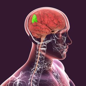 Афазия – когато езикът се разпада, но мисълта остава (подкаст)