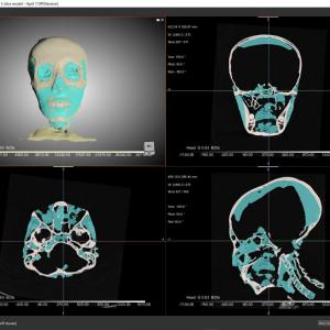 Биоархеолог реконструира лицето на Тутанкамон