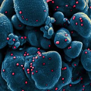 Как започват симптомите на COVID-19 и какво може да очаквате ден по ден