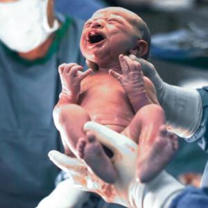 Първият вик на бебето: защо е толкова важен