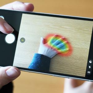 Обикновена снимка на ръката ви може да открие рядко здравословно разстройство