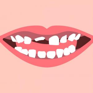 Кога и защо се налага да извадим млечния зъб 