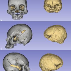 Модерният начин на живот обяснява защо хората в Чили днес са по-високи и с по-големи глави от своите предци