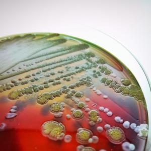 Нов тест показва кои антибиотици действително унищожават опасните бактерии