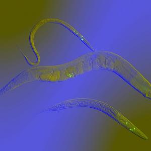 Японска биотехнологична компания използва миниатюрни червеи за ранна диагностика на рак
