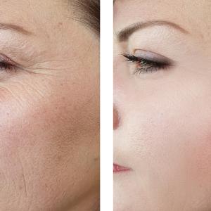 Най-важният признак за остаряването при жените — и това съвсем не са бръчките