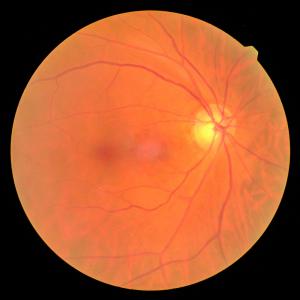 Учени регенерираха успешно оптични нервни клетки на мишка в лабораторни условия