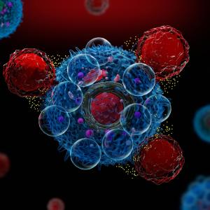 Жена с 3 автоимунни заболявания влезе в ремисия след „рестарт“ на имунната система