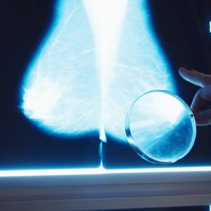 Учени разкриват защо рискът от рак на гърдата се увеличава с възрастта