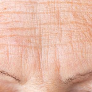 Бръчките ни придават ненадежден вид, установиха немски учени 