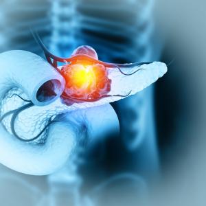 Учени във Франция тестват иРНК терапия за лечение на рак на панкреаса