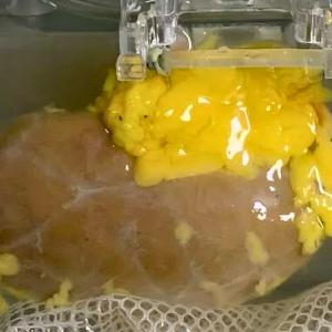 Пробив: Създадоха „универсален“ бъбрек, който пасва на която и да е кръвна група