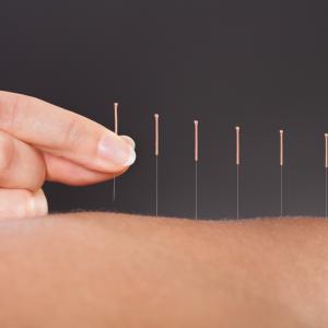 Защо акупунктурата помага?