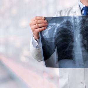 Пушите? Ето кои храни помагат за възстановяване на белите дробове