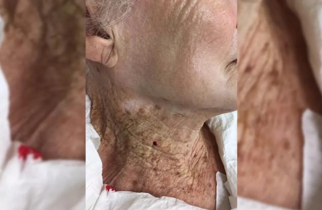 Ето какво се случва, когато 40 години носиш слънцезащитен крем по лицето, но не и по врата