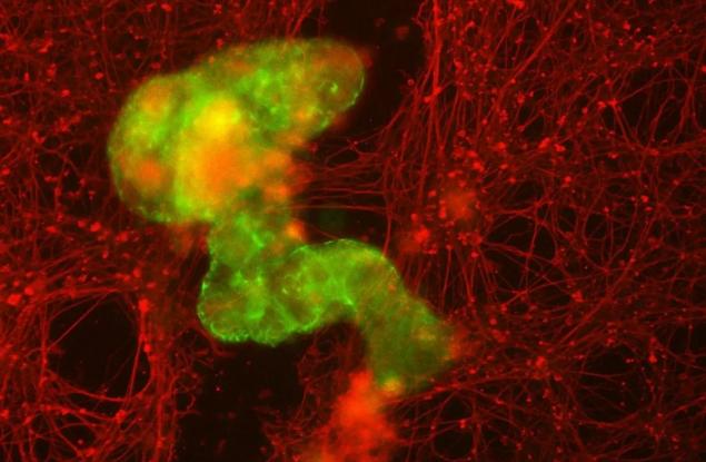 Тези миниатюрни роботи, лекуващи рани, започват живота си като 1 човешка клетка