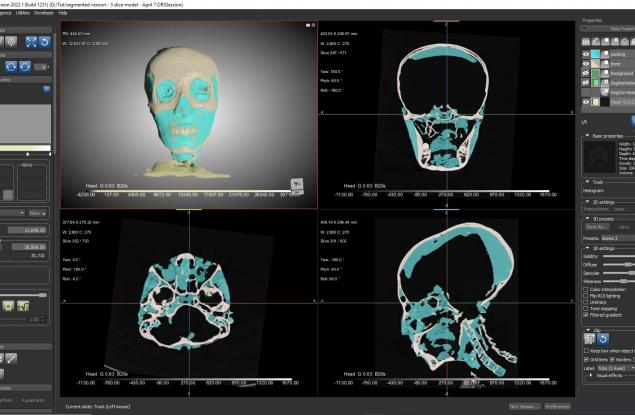 Биоархеолог реконструира лицето на Тутанкамон