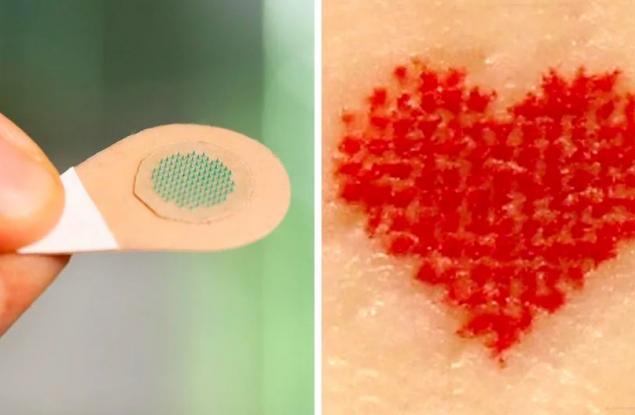 Скоро татуирането може да бъде безболезнено благодарение на тези микроскопични игли, пълни с мастило