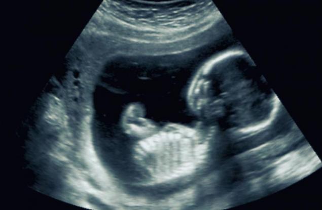 Джесика Алън - жената, която забременява, докато е бременна