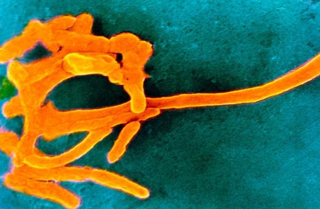 Възможно ли е ендометриозата да се причинява от бактерия? 