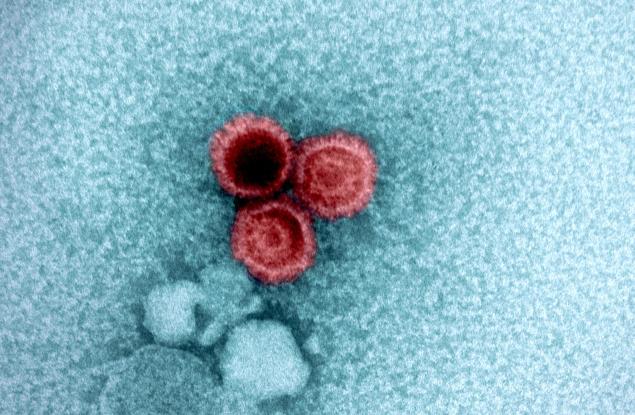 Свързаха лупуса с вирус, който над 95 процента от нас носят – и вече знаем защо