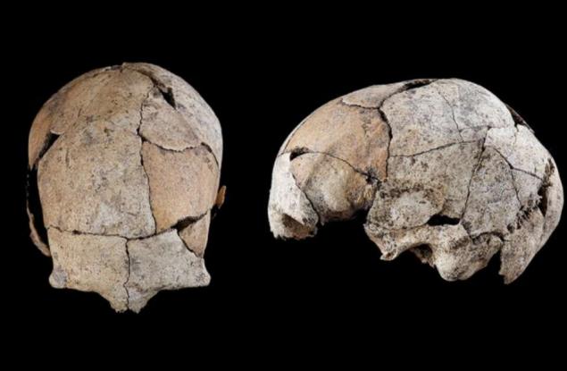 Череп на 5300 години разкрива най-ранните доказателства за хирургия на ушите