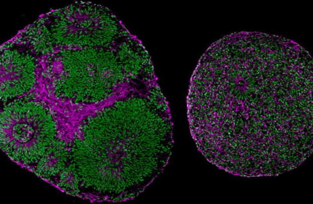 Експеримент възвръща нормалната функция на ген, свързан с аутизма