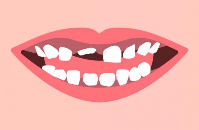 Кога и защо се налага да извадим млечния зъб 