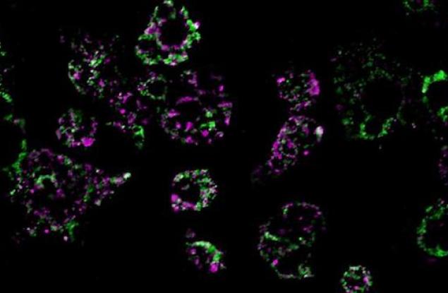 Затлъстяването нарушава работата на митохондриите и вече знаем защо