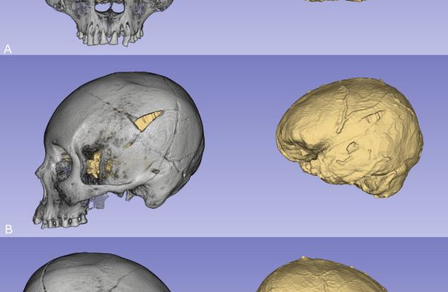 Модерният начин на живот обяснява защо хората в Чили днес са по-високи и с по-големи глави от своите предци