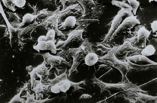 Специфичната генна експресия в подмножеството на В-клетките възпрепятства антитуморното активиране на Т-клетките