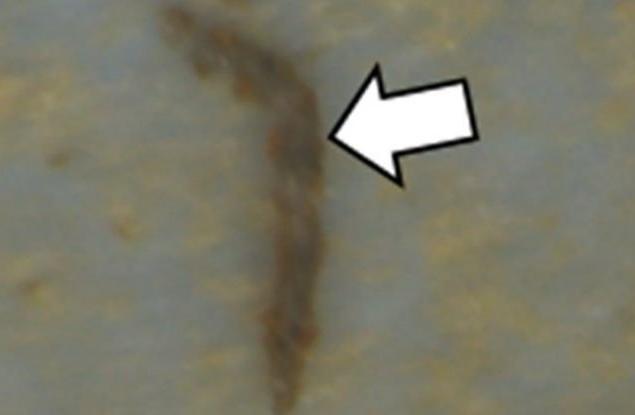 Учените разкриват колко далеч може да стигне пластмасата в белите дробове