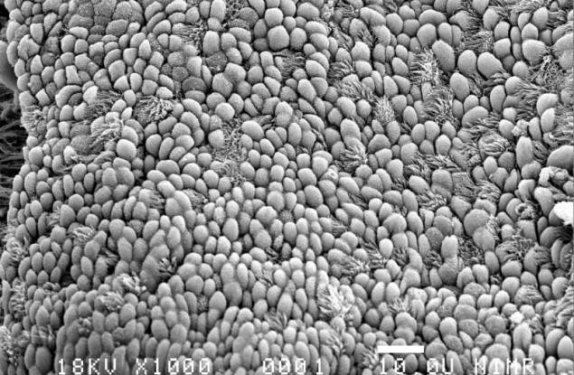 Изследователите разкриват метаболитните процеси, които са ключови за възстановяването на белите дробове
