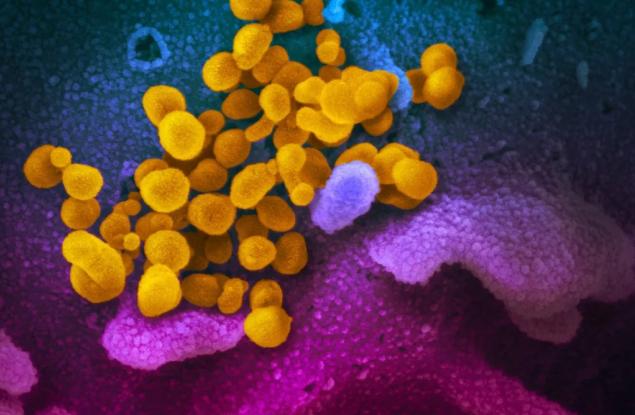 Мозъчни сканирания на хора, преболедували COVID-19, разкриват микроструктурни и химични промени