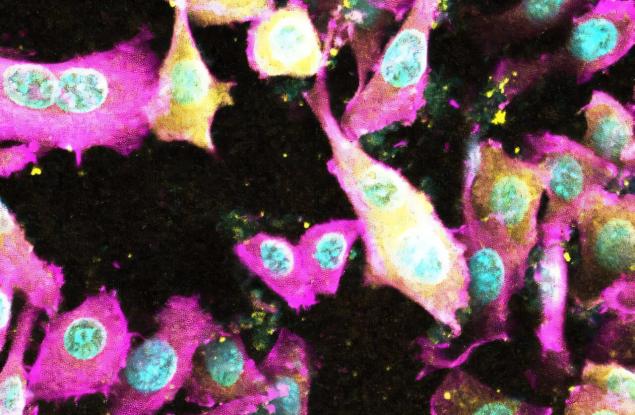 Открит е нов токсин на E. coli, който уврежда червата и застрашава здравето