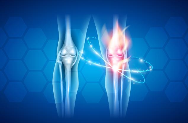 3 храни за здрави стави