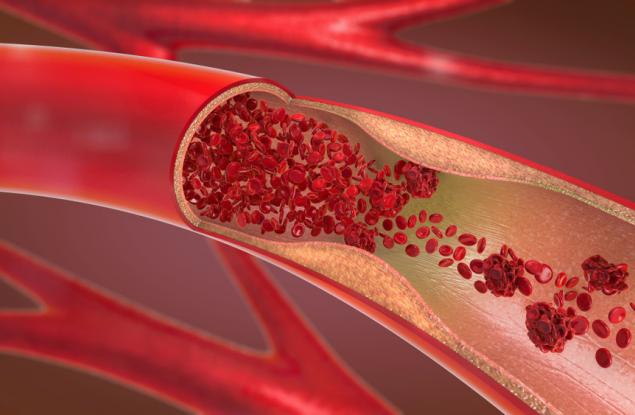 Откриха най-смъртоносната модерна болест в мумии на 500 години